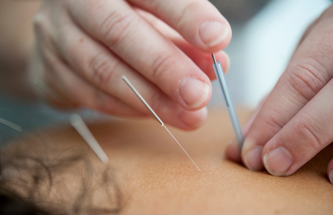 Acupuncture treatment in a clinic setting
